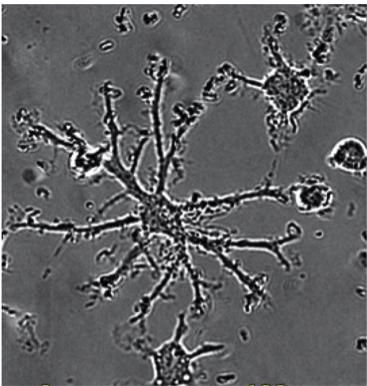 microglia